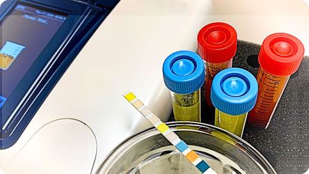 UriScan urine test strip beside sample tubes and a urine analyzer